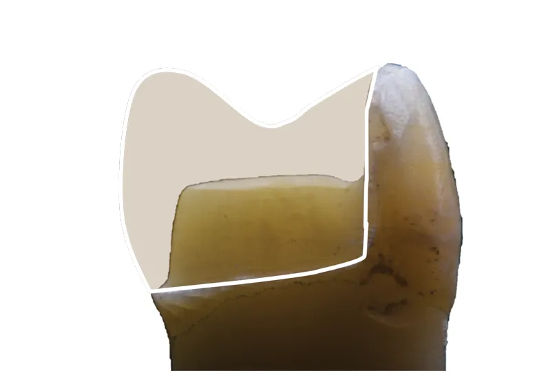 31375 31375