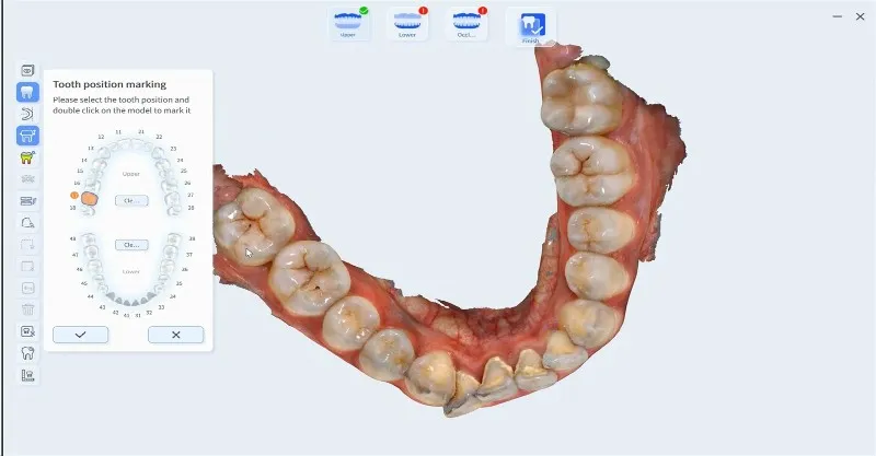 vsmile Oral Scanner vsmile Oral Scanner
